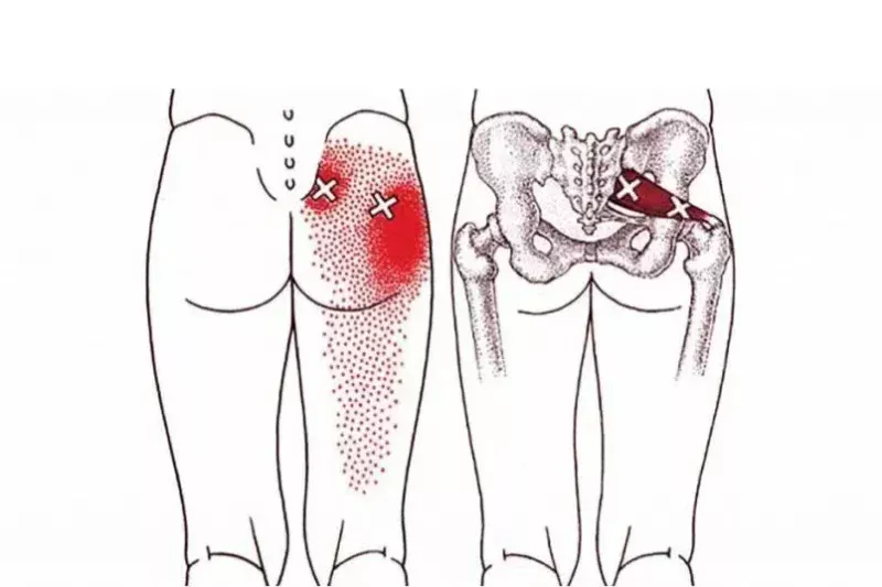 Top 10 Exercises For Piriformis Syndrome To Help You Get Rid Of Your Pain – Piriformis Stretches To Remove Hip And Lower Back Pain